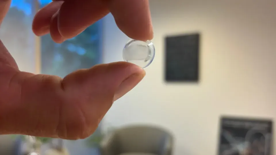 Best Contact Lenses for Keratoconus: Scleral, GP, Hybrid, and Custom Options Compared