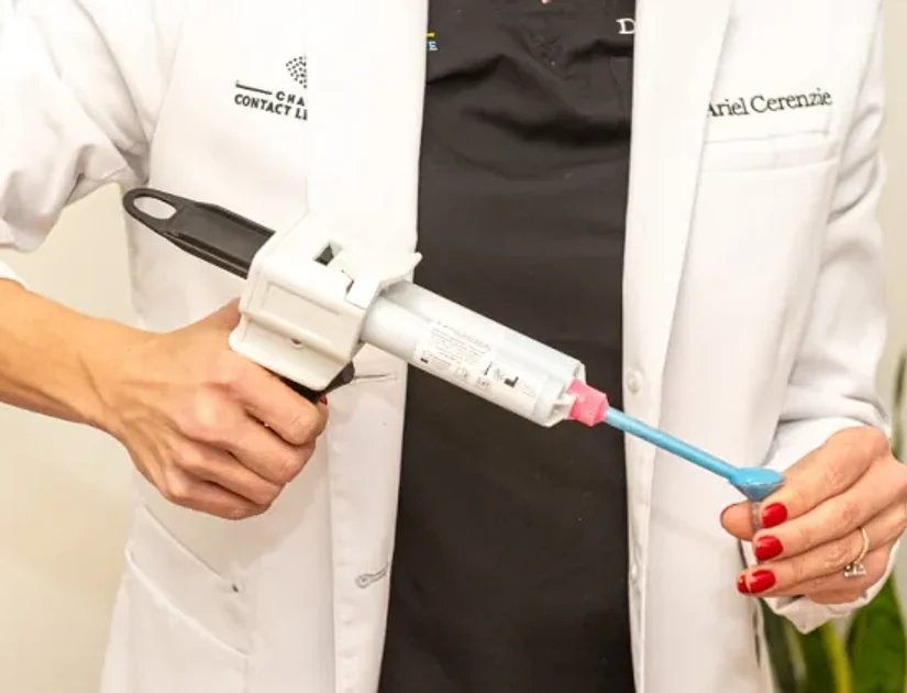 Slit-lamp examination verifying vault clearance and edge contour of EyePrintPRO lens