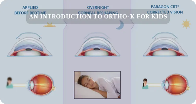Orthokeratology educational video preview