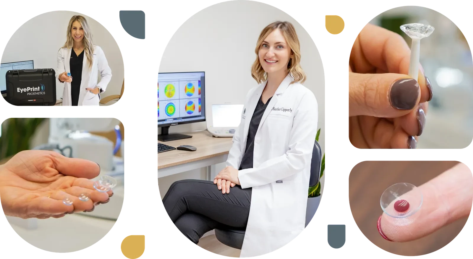 SynergEyes hybrid contact lens precision fitting at Charlotte Contact Lens Institute