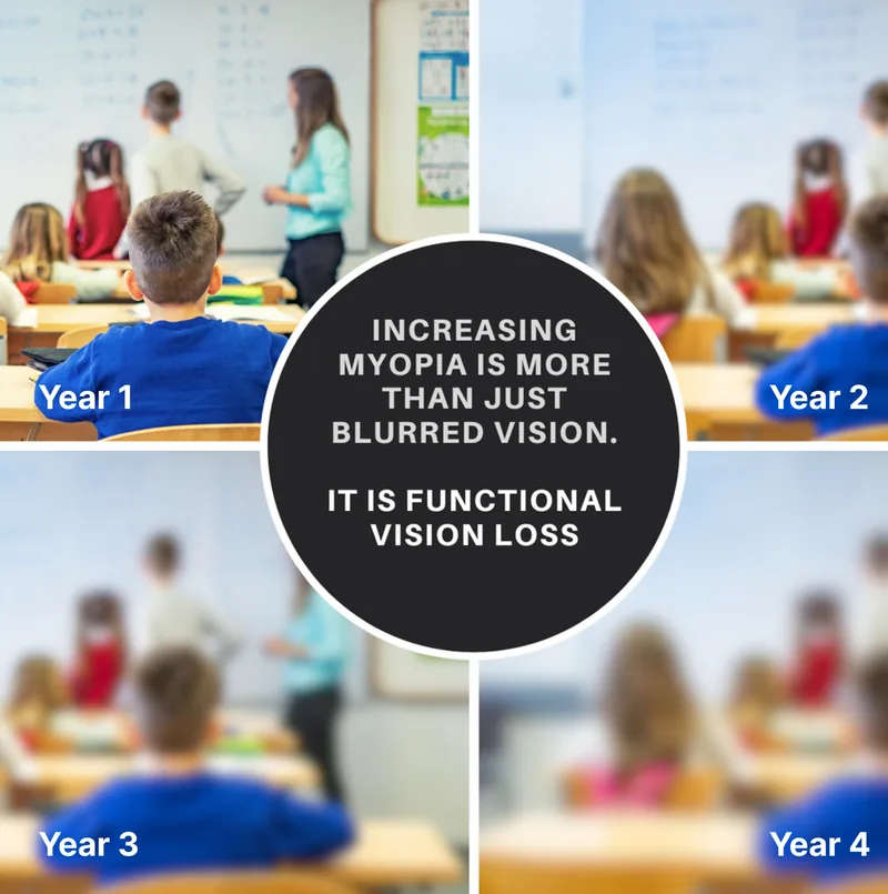Child undergoing detailed visual growth tracking and axial length measurement